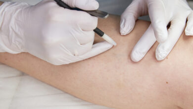 Photo of Электроэпиляция: эффективное решение для удаления нежелательных волос